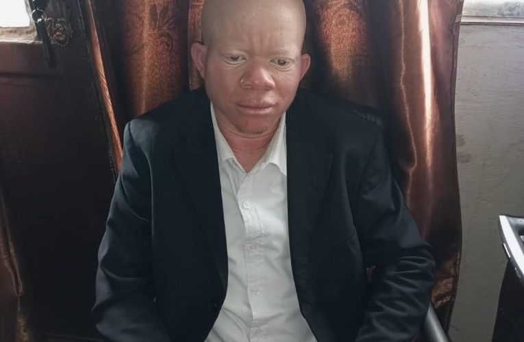 RDC/ Kasaï : les albinos saluent la volonté du président de la république manifesté à travers l’ONIP pour l’identification de la population